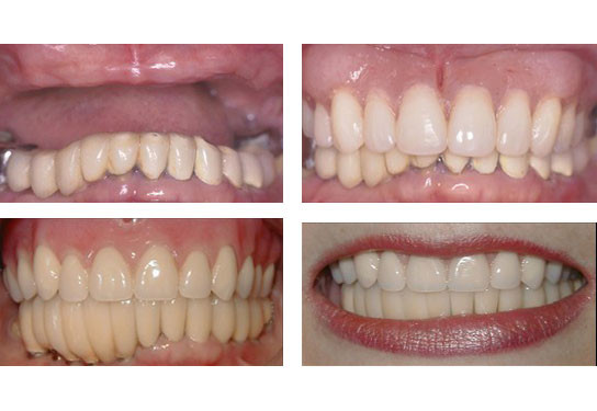 Before and After images